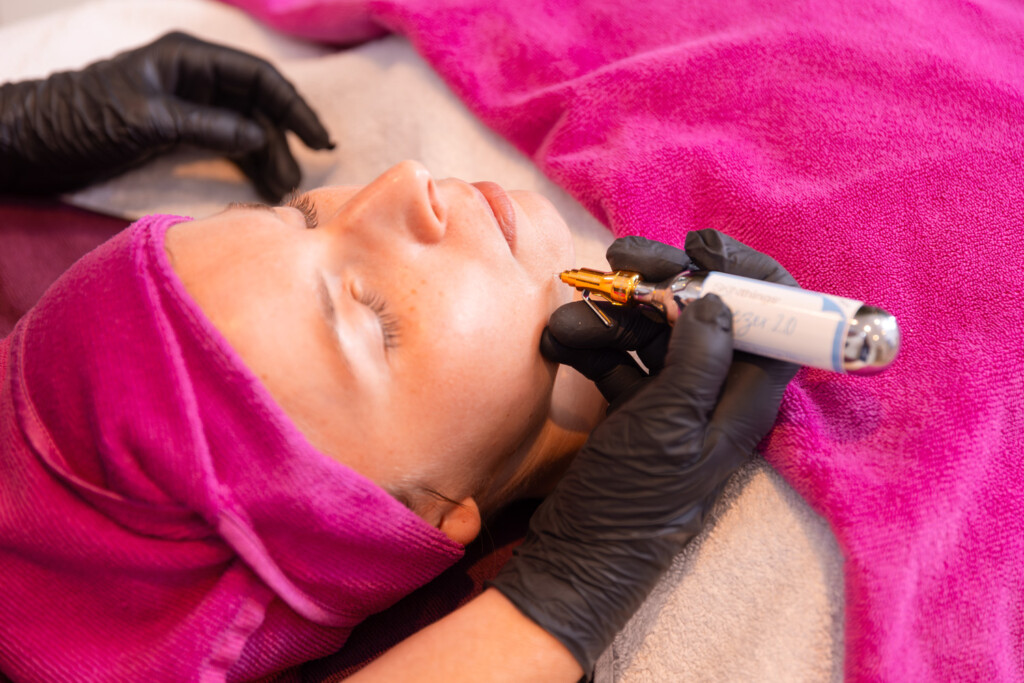 CRYO Therapie Kältetherapie